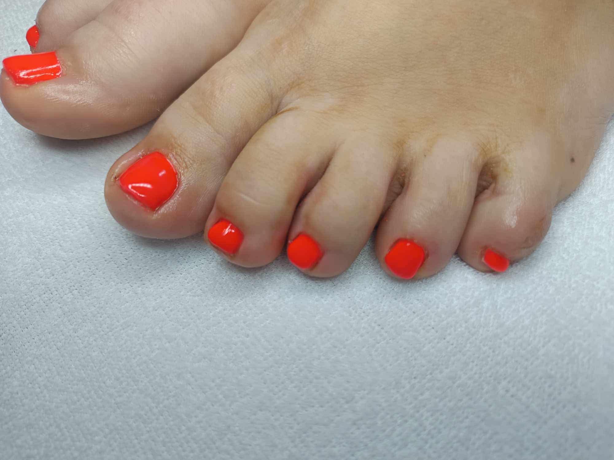 Pedicina munka 1